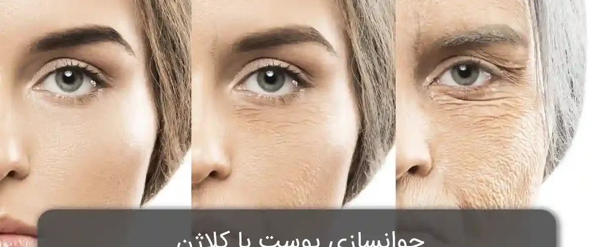 جوانسازی پوست با کلاژن