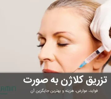 تزریق کلاژن به صورت