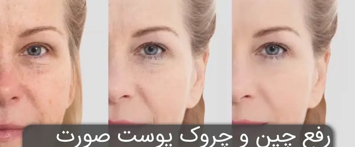 رفع چین و چروک پوست صورت