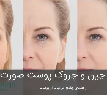 رفع چین و چروک پوست صورت